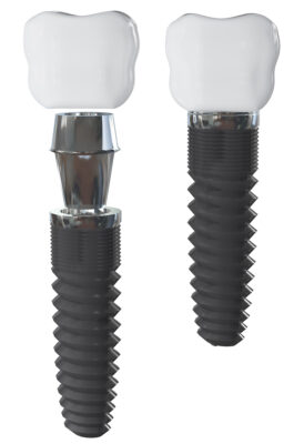 The two-step process of dental implants is illustrated.