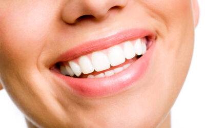 Are Porcelain Veneers Right for You?