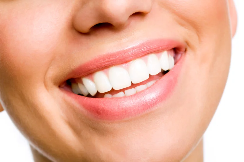 Are Porcelain Veneers Right for You?