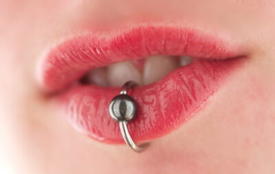 If you have a lip piercing, check the gums nearby for recession.