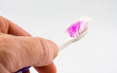 Should You Change Your Toothbrush?