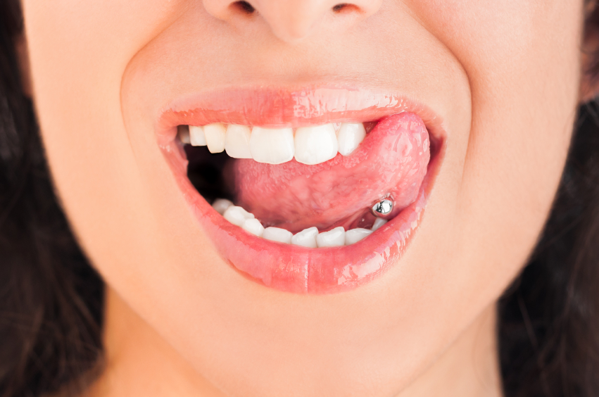 Tongue Piercings and Dental Health