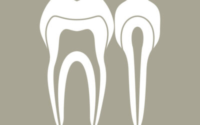 Tooth Saving Root Canal Therapy