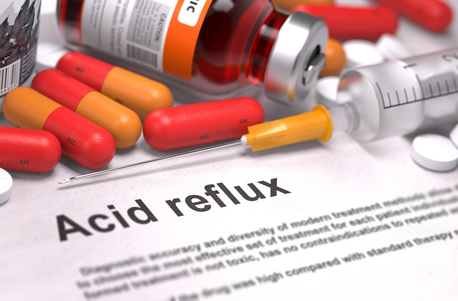Acid Reflux and Dental Health