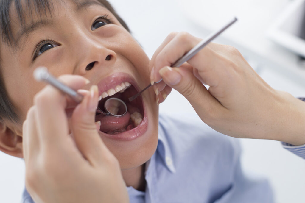 How to Avoid Cavities