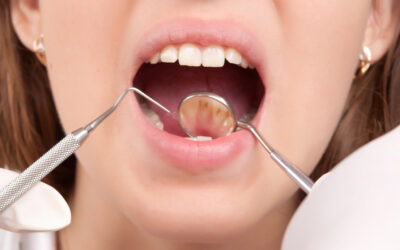 The Pinhole Surgical Technique for Gum Recession