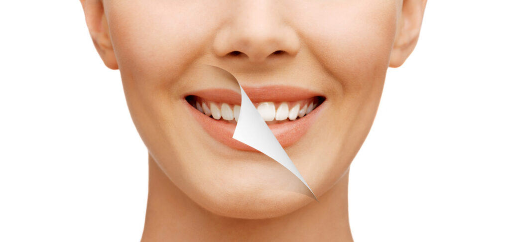 A Whiter Smile Is Possible!