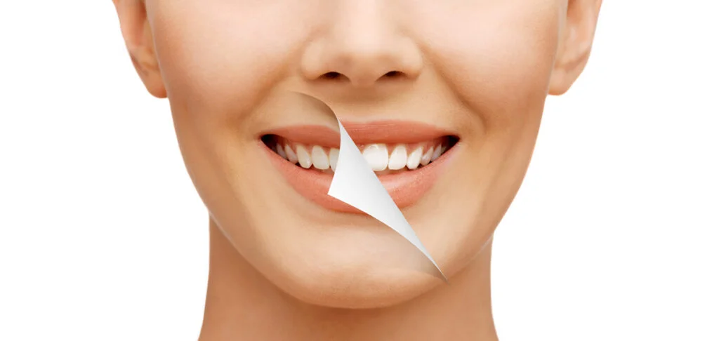 A Whiter Smile Is Possible!