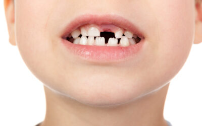Why Do Children Have Jagged Teeth?