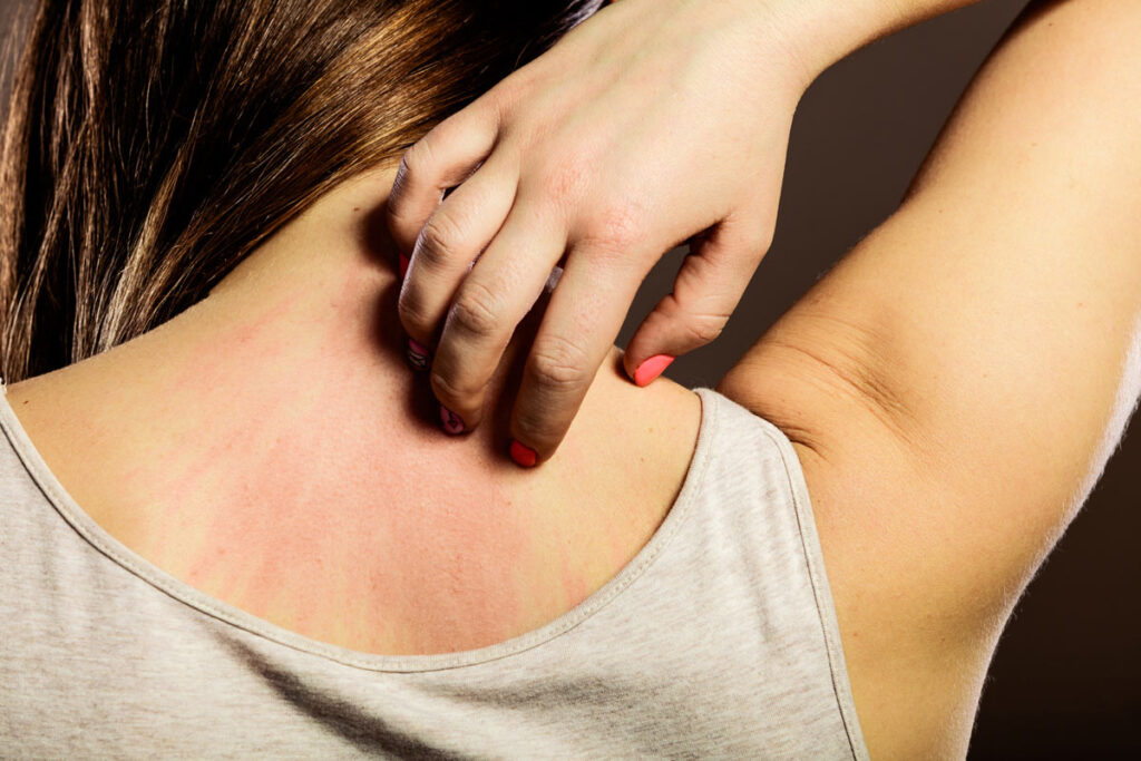 Gum Disease and Psoriasis