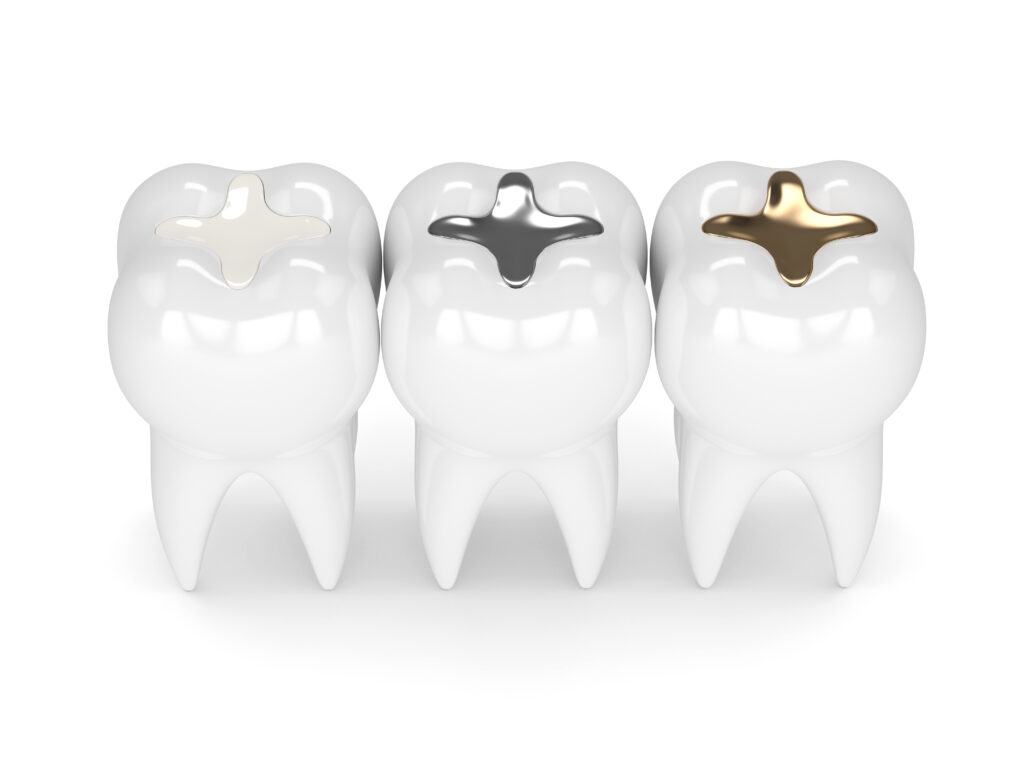 Don’t Fear Fillings