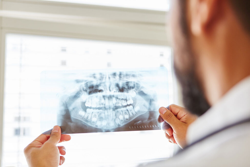 Are your Teeth Floating?