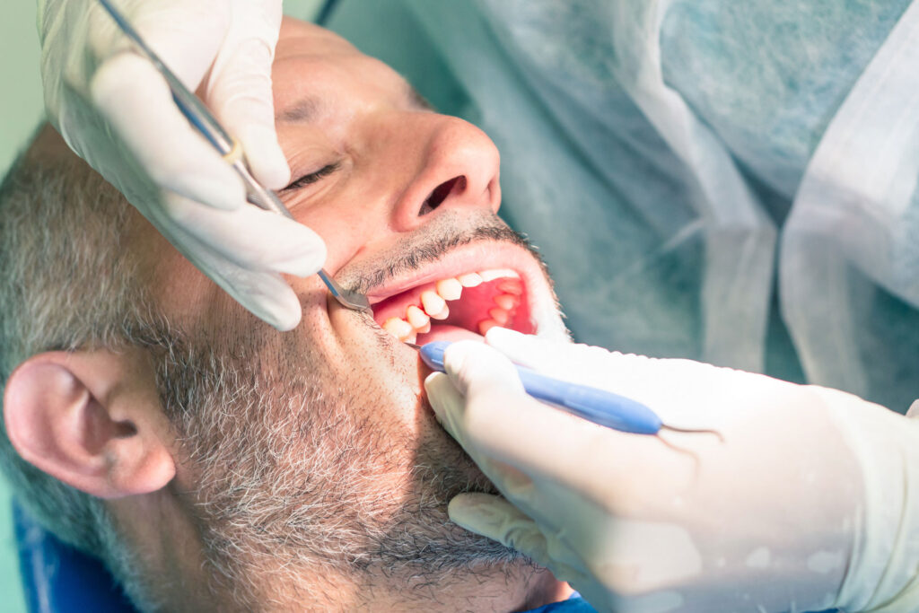 Debridement in Dentistry