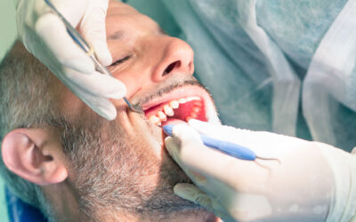 Debridement in Dentistry