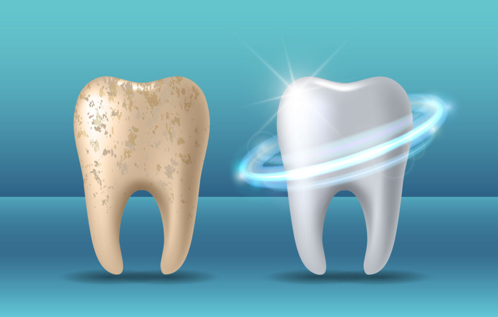 Your Amazing Tooth Enamel