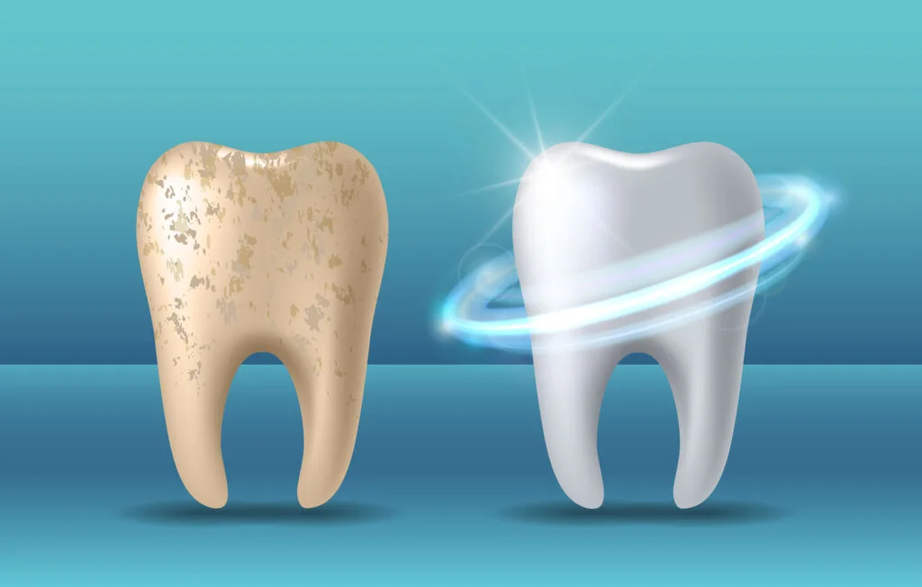 Your Amazing Tooth Enamel