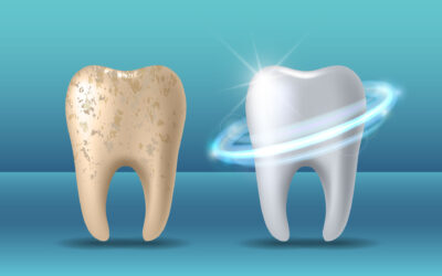 Your Amazing Tooth Enamel