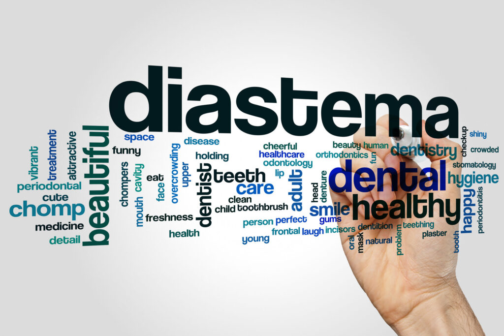 Dental Diastemas