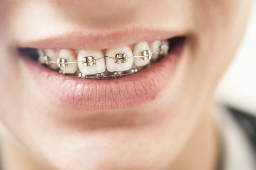 How are Your Dental Arches?
