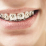 Dental Arches