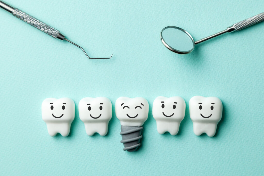 What are Dental Implants?