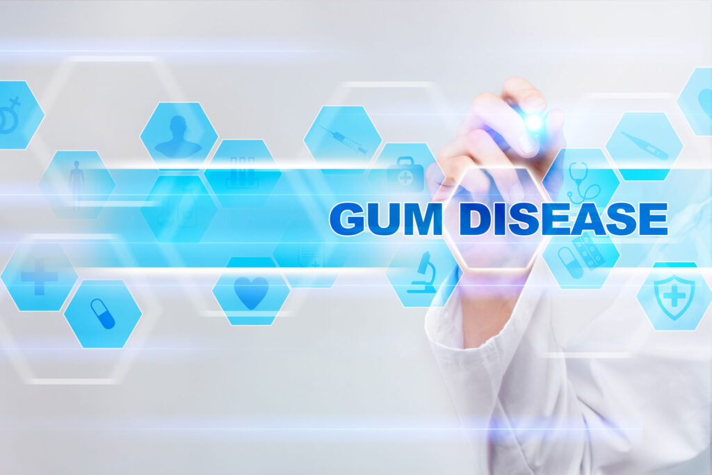 The Gum Disease and Arthritis Connection