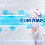Arthritis & Gum Disease