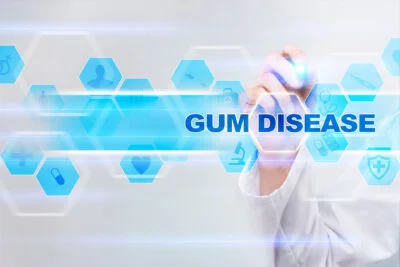 Arthritis & Gum Disease