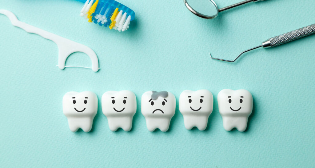 Emergency Dentistry – Damaged Dental Fillings