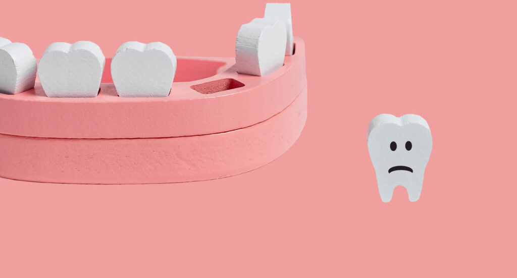Treating Dental Trauma