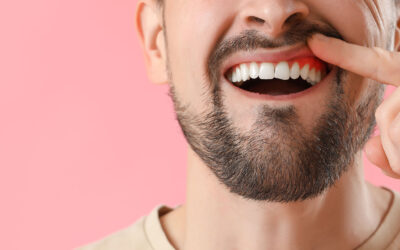 What to Do for Wounded Gums