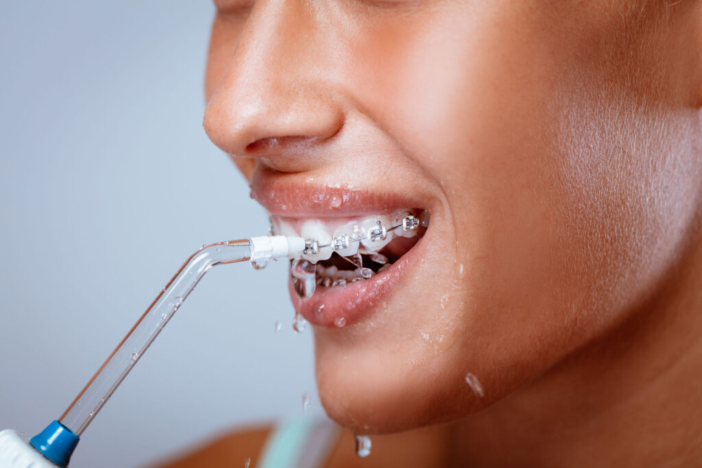 Water Flossers and Dental Health