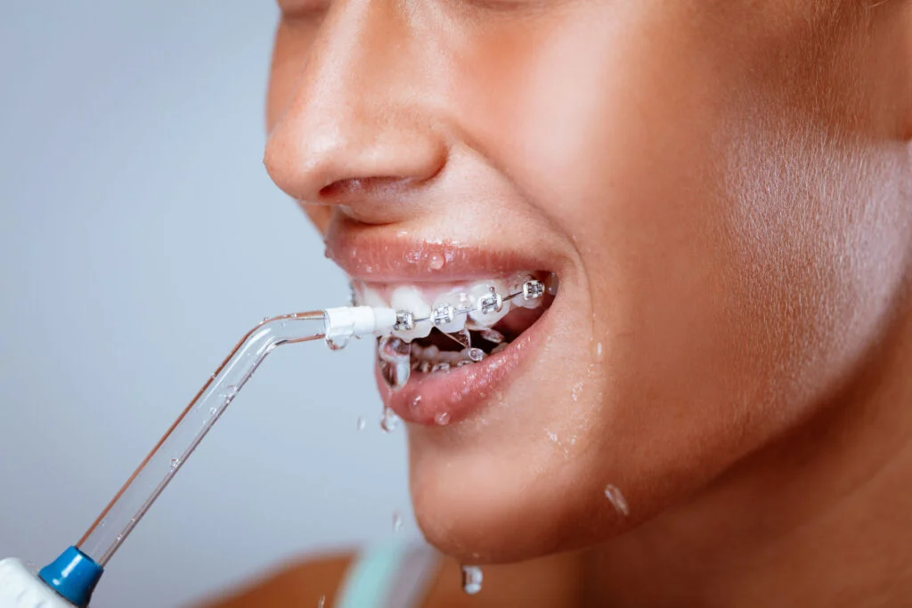 Water Flossers and Dental Health