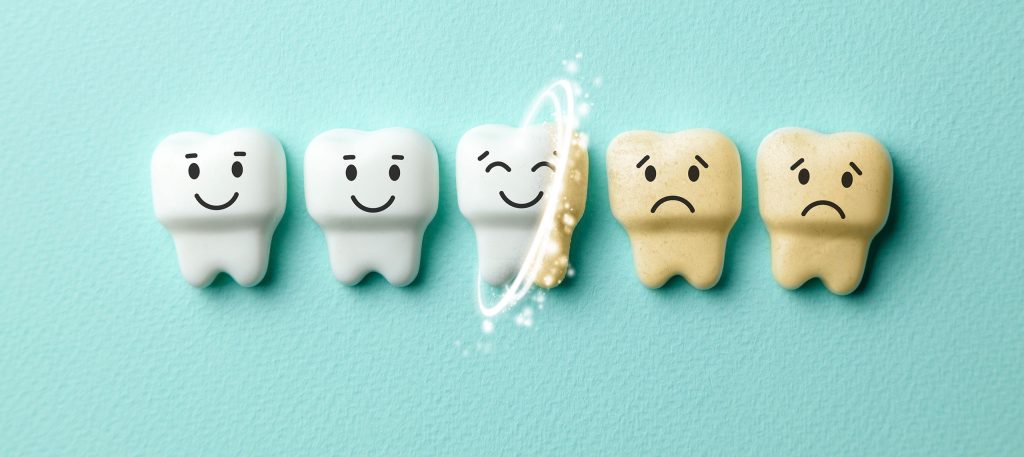 How White Are Your Teeth?