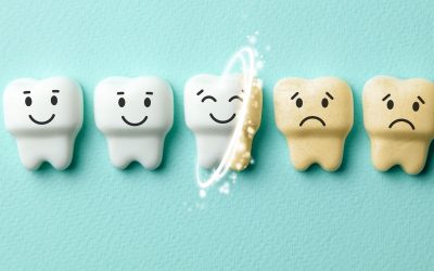 How White Are Your Teeth?