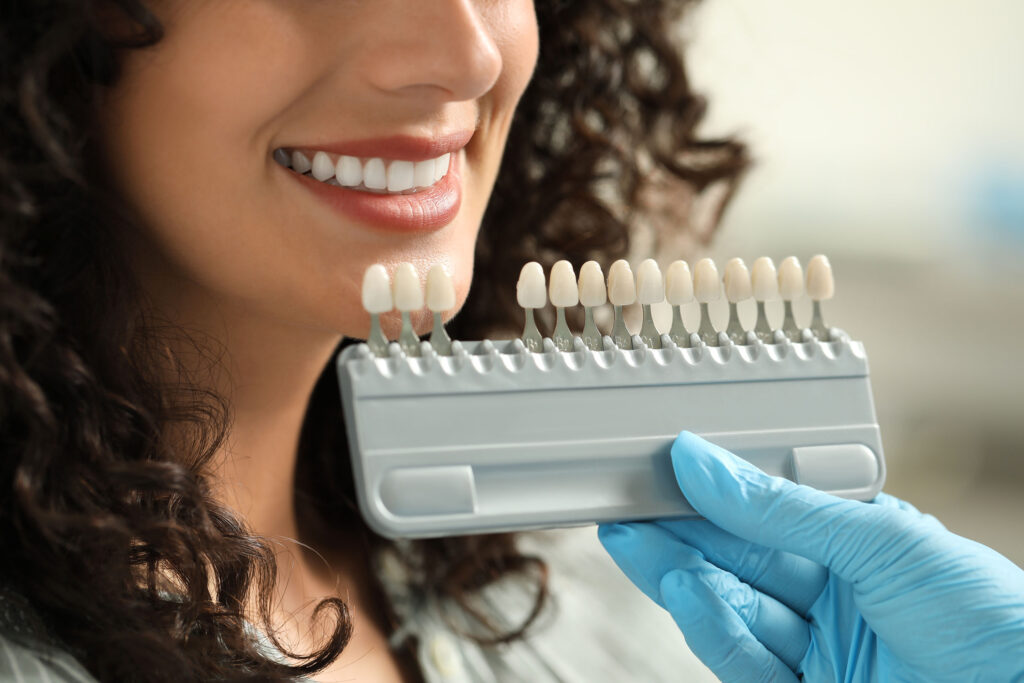Cosmetic Dentistry That Fits Your Budget